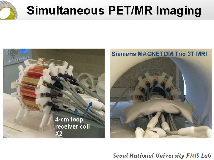 Simultaneous PET/MR Imaging Siemens MAGNETOM Trio 3 T MRI 4 -cm loop receiver coil