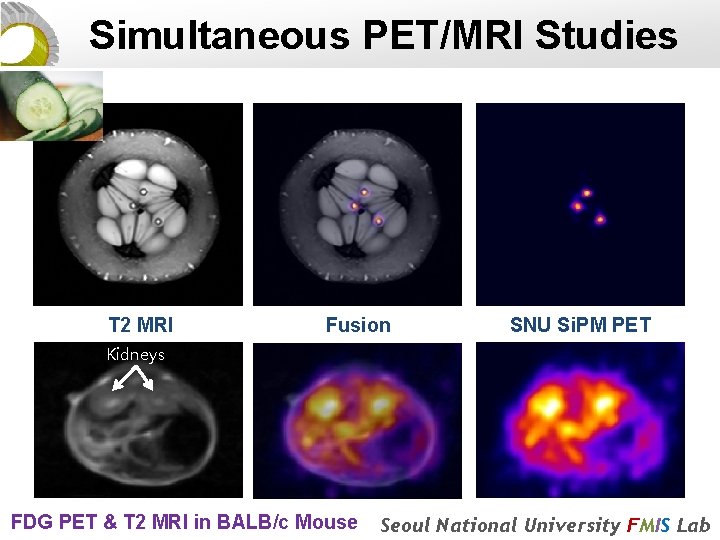 Simultaneous PET/MRI Studies T 2 MRI Fusion SNU Si. PM PET Kidneys FDG PET