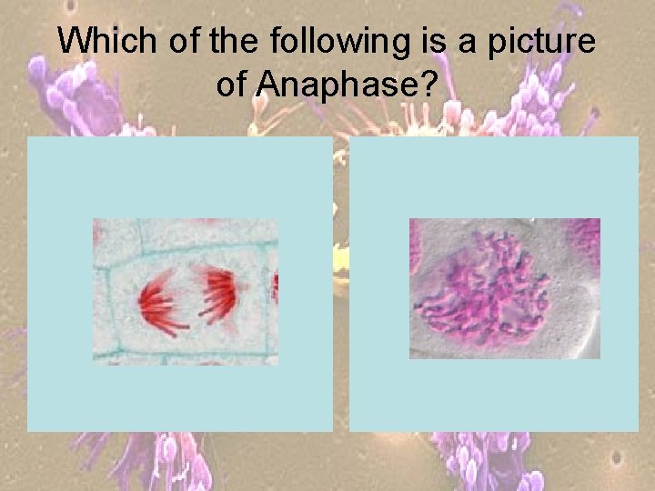 Which of the following is a picture of Anaphase? 