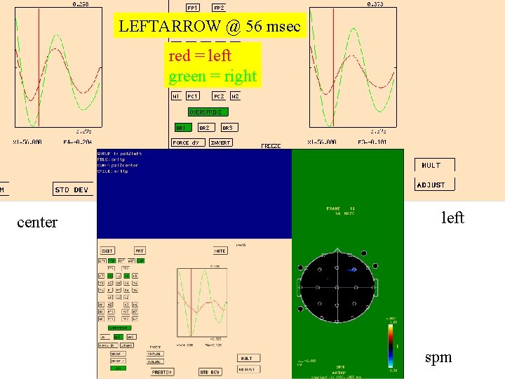 LEFTARROW @ 56 msec red = left green = right center left spm 