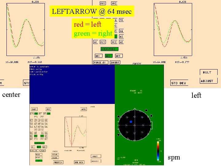 LEFTARROW @ 64 msec red = left green = right center left spm 