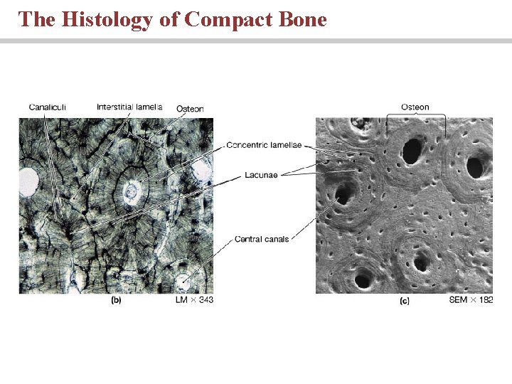The Histology of Compact Bone 