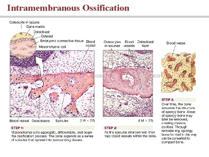Intramembranous Ossification 