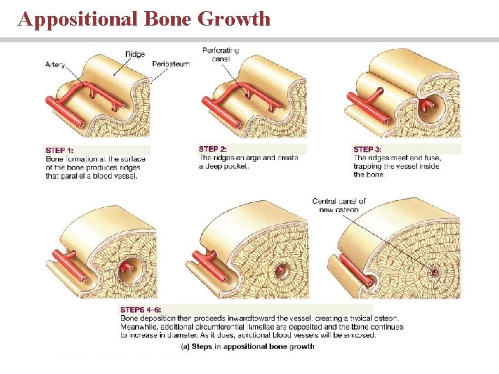 Appositional Bone Growth 