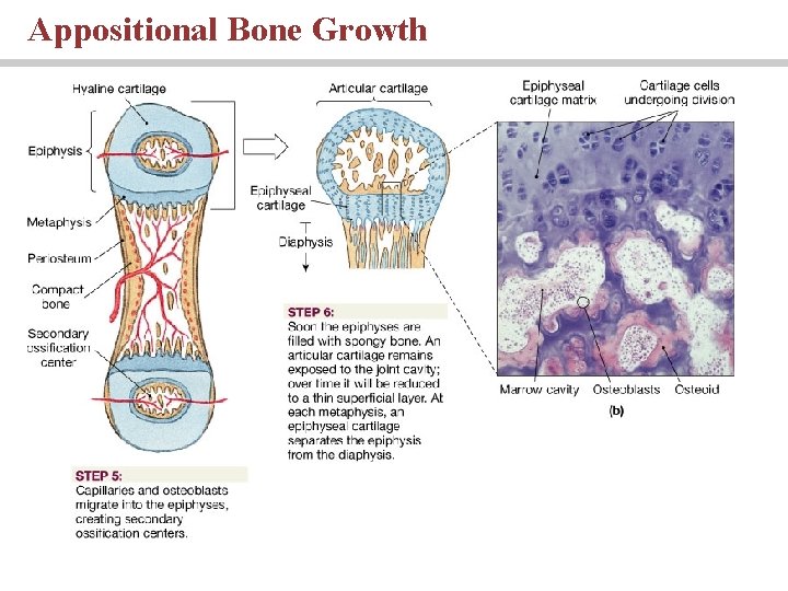 Appositional Bone Growth 