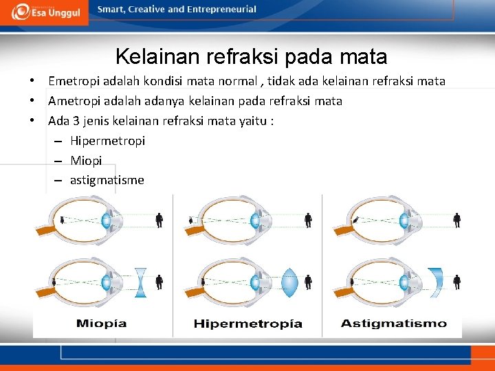 Kelainan refraksi pada mata • Emetropi adalah kondisi mata normal , tidak ada kelainan