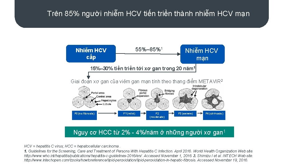 Trên 85% người nhiễm HCV tiến triển thành nhiễm HCV mạn 55%– 85%1 Nhiễm