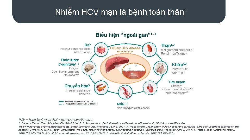 Nhiễm HCV mạn là bệnh toàn thân 1 Biểu hiện “ngoài gan” 1– 3