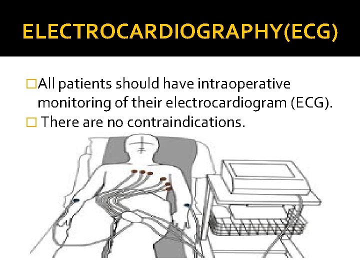 ELECTROCARDIOGRAPHY(ECG) �All patients should have intraoperative monitoring of their electrocardiogram (ECG). � There are ELECTROCARDIOGRAPHY(ECG) �All patients should have intraoperative monitoring of their electrocardiogram (ECG). � There are