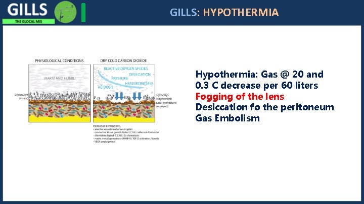 I GILLS: HYPOTHERMIA Hypothermia: Gas @ 20 and 0. 3 C decrease per 60