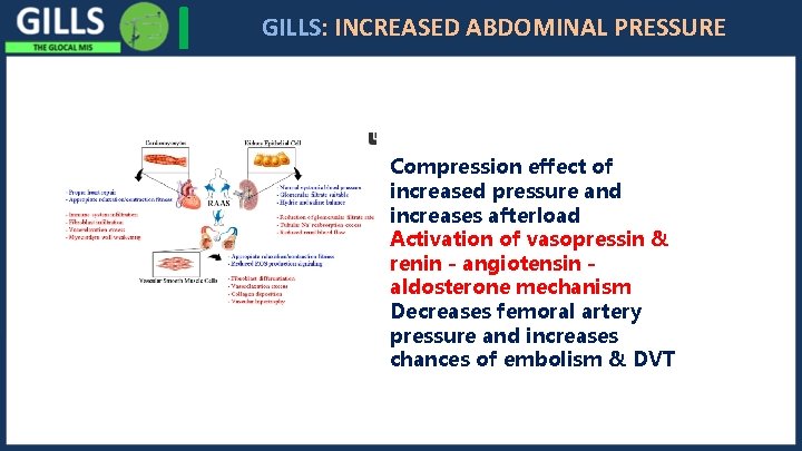 I GILLS: INCREASED ABDOMINAL PRESSURE Compression effect of increased pressure and increases afterload Activation