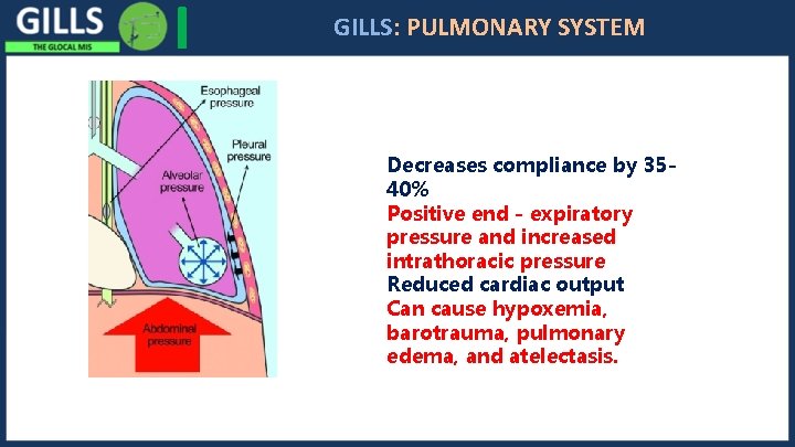 I GILLS: PULMONARY SYSTEM Decreases compliance by 3540% Positive end - expiratory pressure and