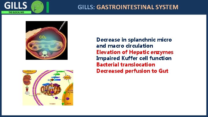 I GILLS: GASTROINTESTINAL SYSTEM Decrease in splanchnic micro and macro circulation Elevation of Hepatic