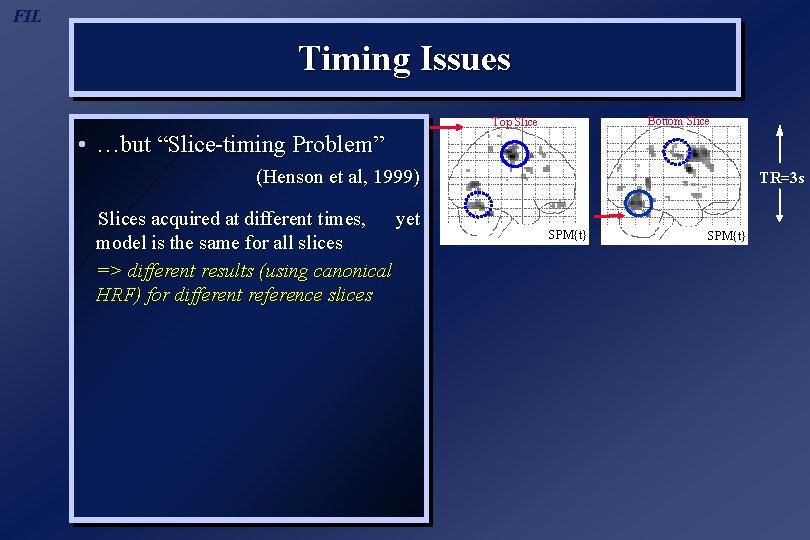 FIL Timing Issues Bottom Slice Top Slice • …but “Slice-timing Problem” (Henson et al,