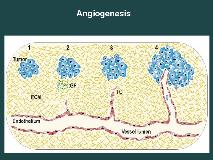 Angiogenesis 