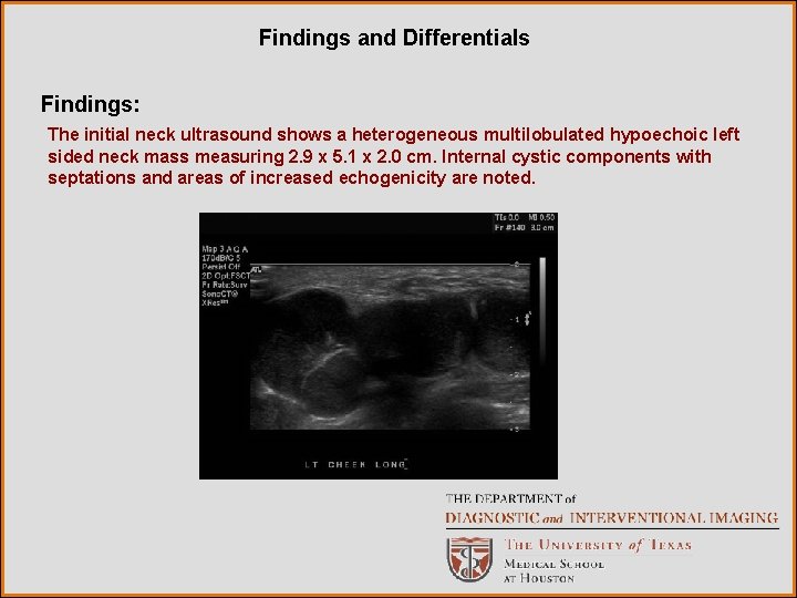 Findings and Differentials Findings: The initial neck ultrasound shows a heterogeneous multilobulated hypoechoic left