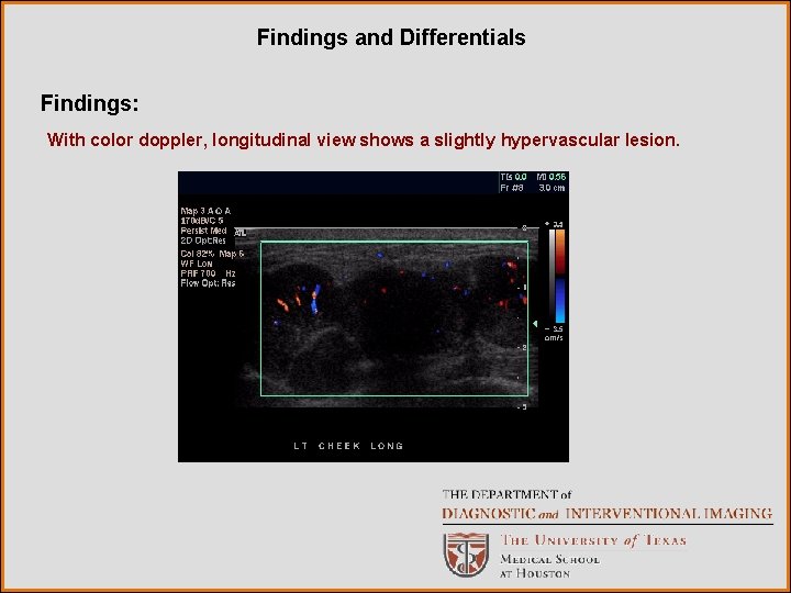 Findings and Differentials Findings: With color doppler, longitudinal view shows a slightly hypervascular lesion.