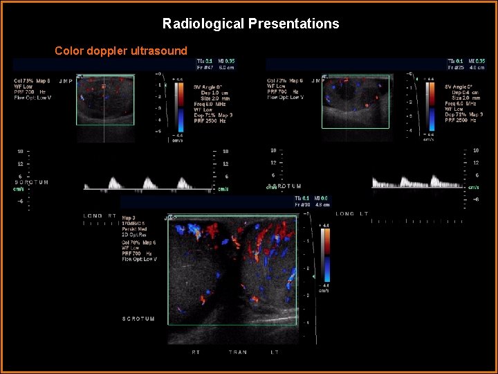 Radiological Presentations Color doppler ultrasound 