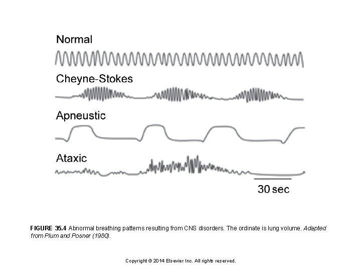 Basic Cns Pattern Chapter 35 Neural Control of Breathing Copyright 2014