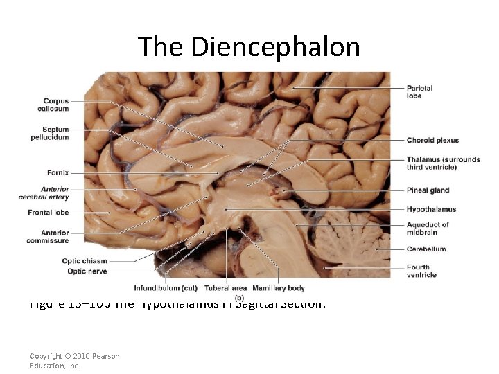 The Diencephalon Figure 13– 10 b The Hypothalamus in Sagittal Section. Copyright © 2010