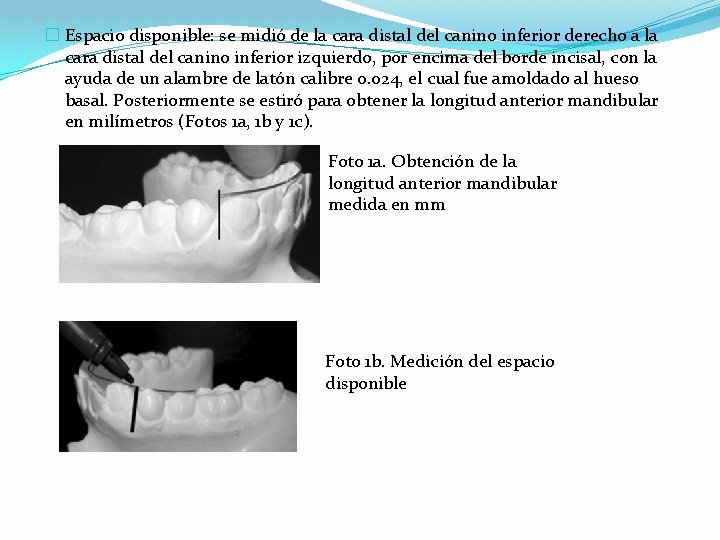 � Espacio disponible: se midió de la cara distal del canino inferior derecho a