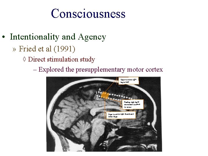 Consciousness • Intentionality and Agency » Fried et al (1991) ◊ Direct stimulation study