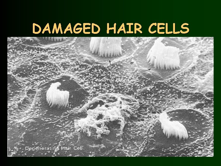DAMAGED HAIR CELLS 