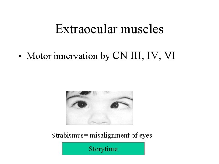 Extraocular muscles • Motor innervation by CN III, IV, VI Strabismus= misalignment of eyes