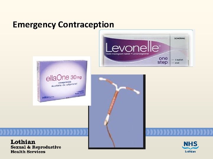 Emergency Contraception 