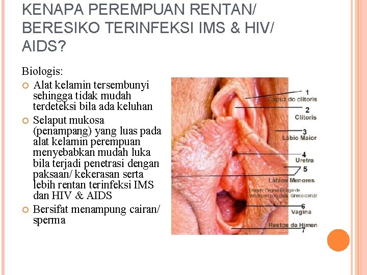 KENAPA PEREMPUAN RENTAN/ BERESIKO TERINFEKSI IMS & HIV/ AIDS? Biologis: Alat kelamin tersembunyi sehingga