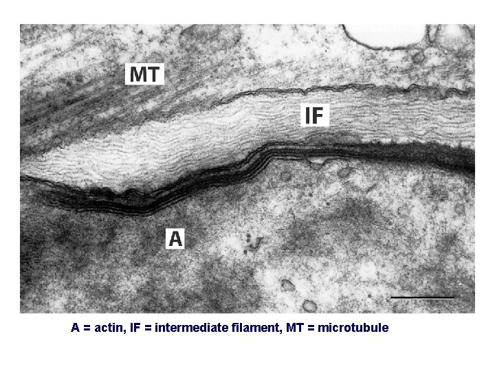 A = actin, IF = intermediate filament, MT = microtubule 