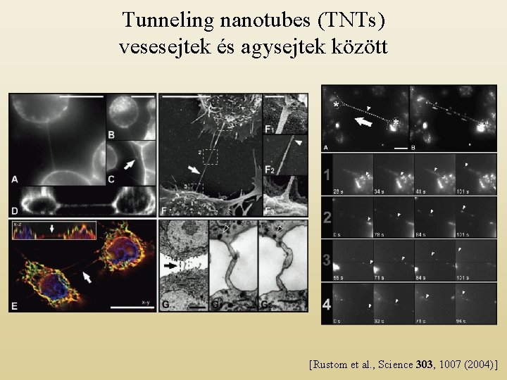 Tunneling nanotubes (TNTs) vesesejtek és agysejtek között [Rustom et al. , Science 303, 1007