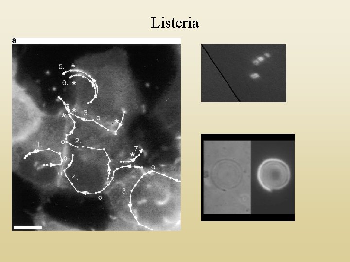 Listeria 