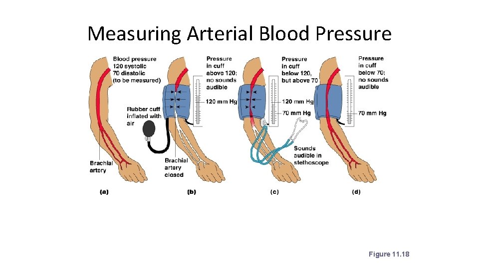 Measuring Arterial Blood Pressure Figure 11. 18 