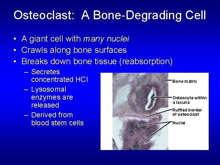 Osteoclast: A Bone-Degrading Cell • A giant cell with many nuclei • Crawls along