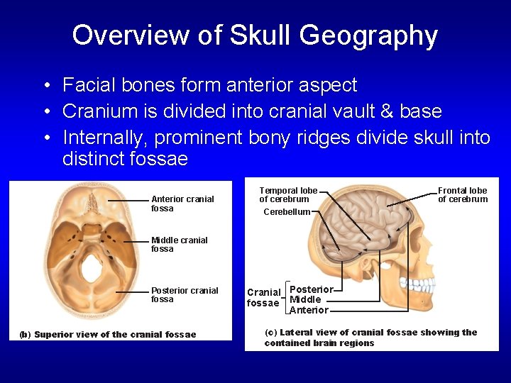 Overview of Skull Geography • Facial bones form anterior aspect • Cranium is divided