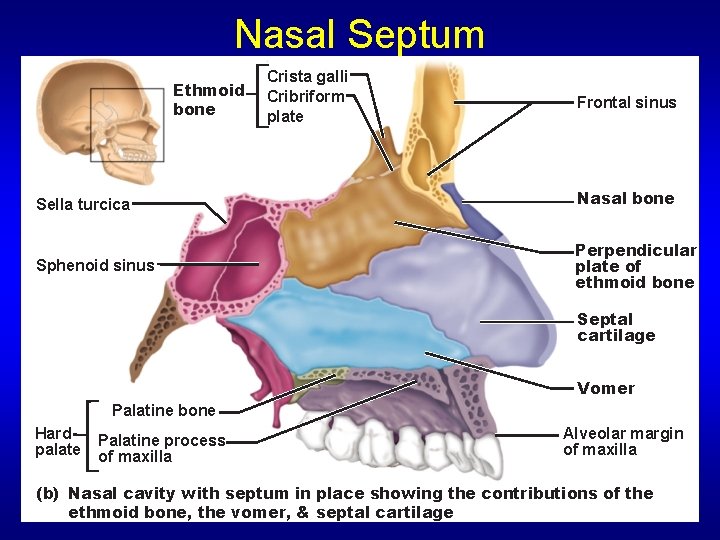 Nasal Septum Ethmoid bone Crista galli Cribriform plate Frontal sinus Sella turcica Nasal bone