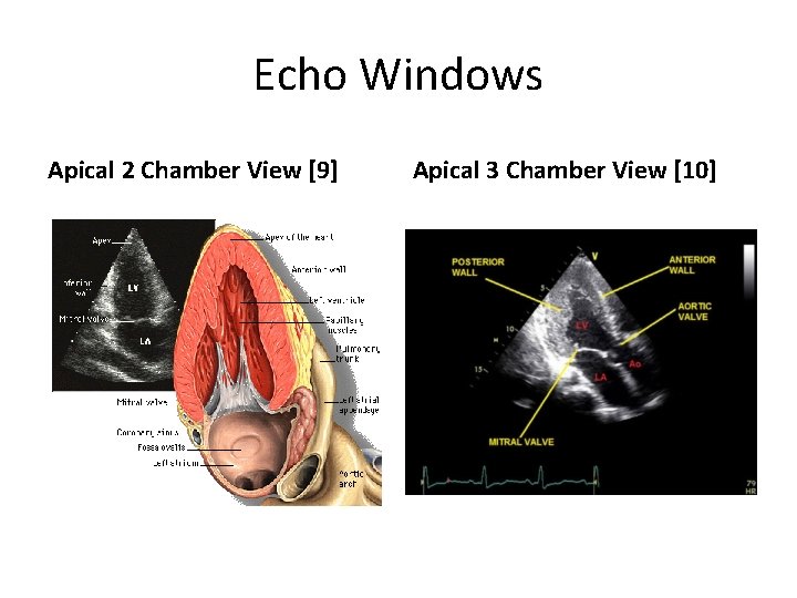 Echo Windows Apical 2 Chamber View [9] Apical 3 Chamber View [10] 