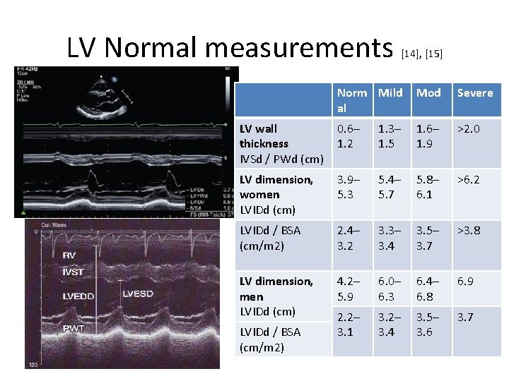 LV Normal measurements [14], [15] Norm Mild al Mod Severe LV wall thickness IVSd