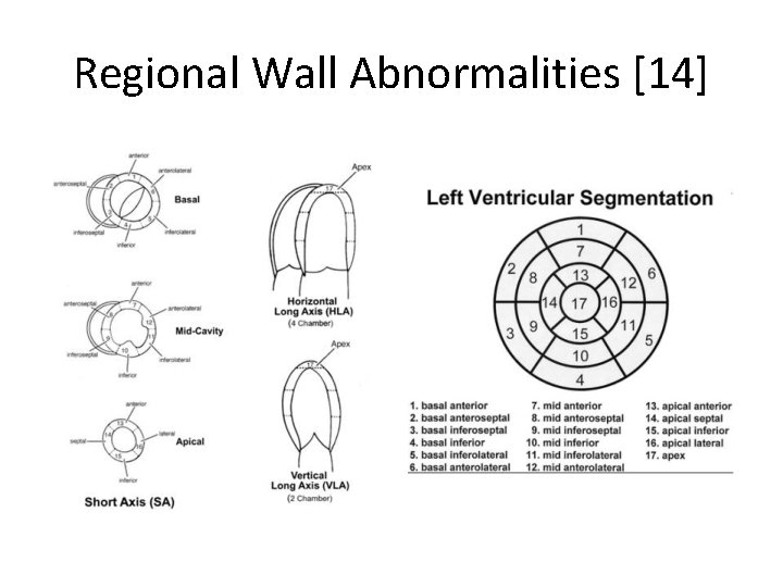 Regional Wall Abnormalities [14] 