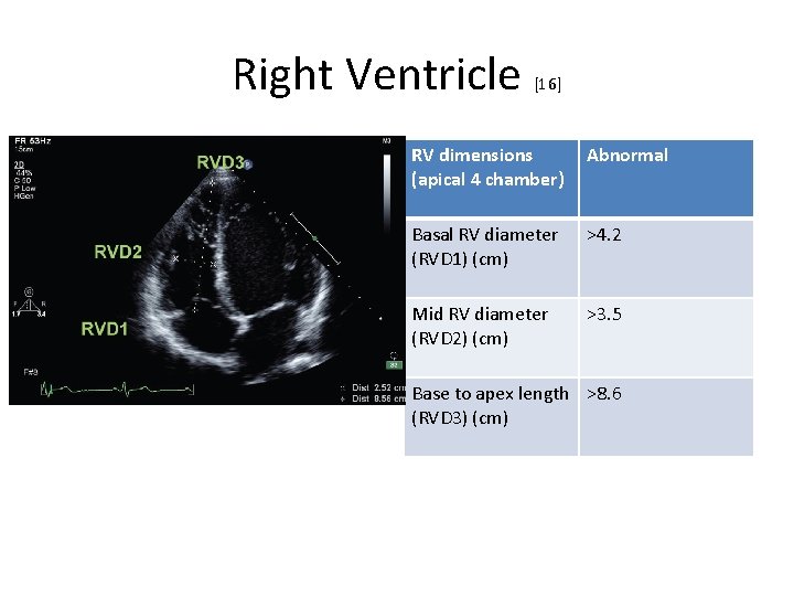 Right Ventricle [16] RV dimensions (apical 4 chamber) Abnormal Basal RV diameter (RVD 1)