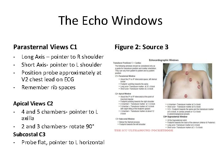The Echo Windows Parasternal Views C 1 - Long Axis – pointer to R