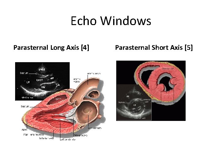 Echo Windows Parasternal Long Axis [4] Parasternal Short Axis [5] 