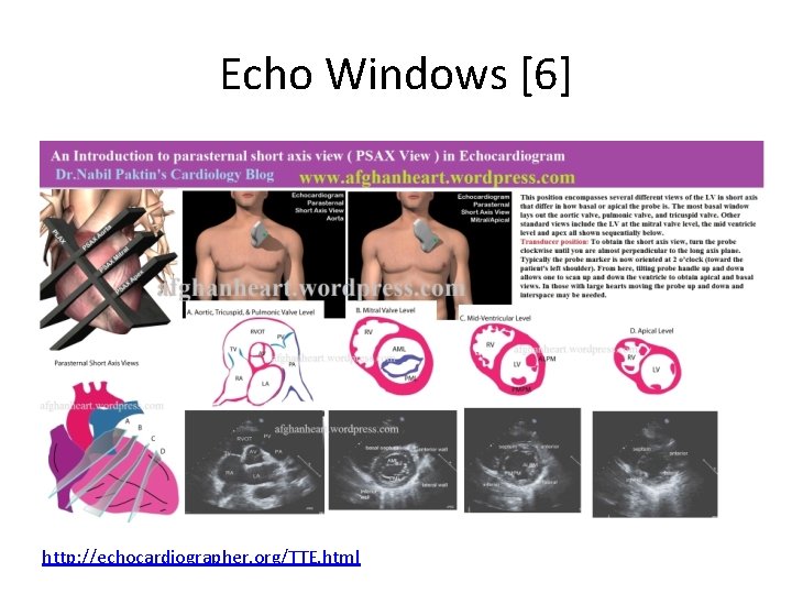 Echo Windows [6] http: //echocardiographer. org/TTE. html 