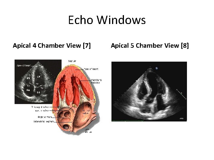 Echo Windows Apical 4 Chamber View [7] Apical 5 Chamber View [8] 