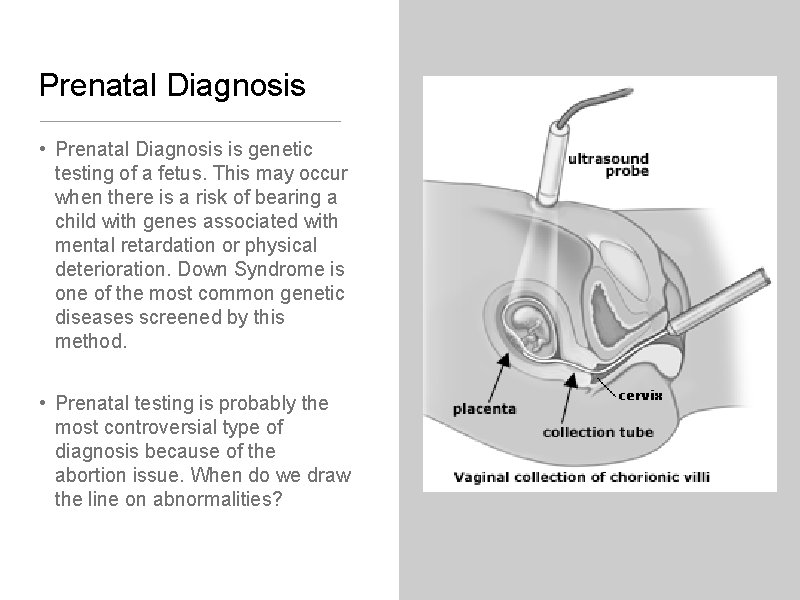 Prenatal Diagnosis • Prenatal Diagnosis is genetic testing of a fetus. This may occur