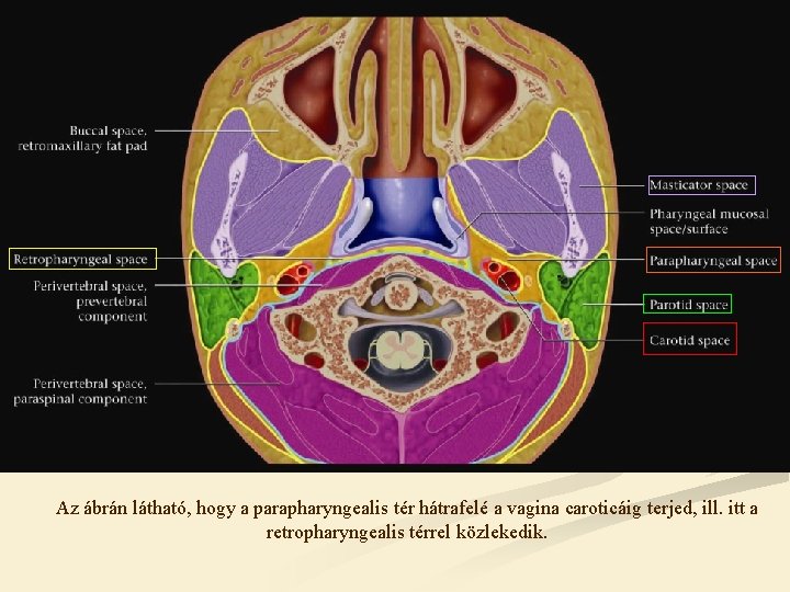 Az ábrán látható, hogy a parapharyngealis tér hátrafelé a vagina caroticáig terjed, ill. itt