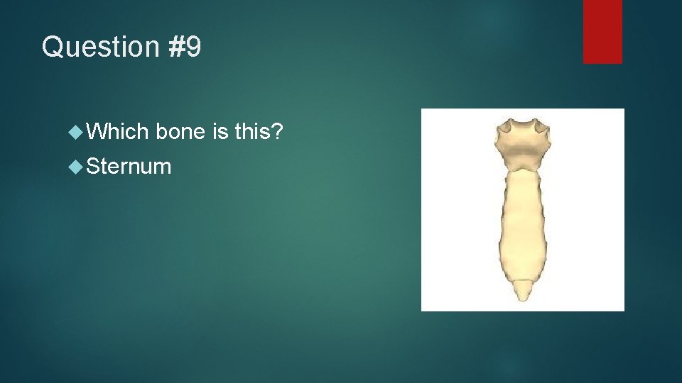 Question #9 Which bone is this? Sternum 