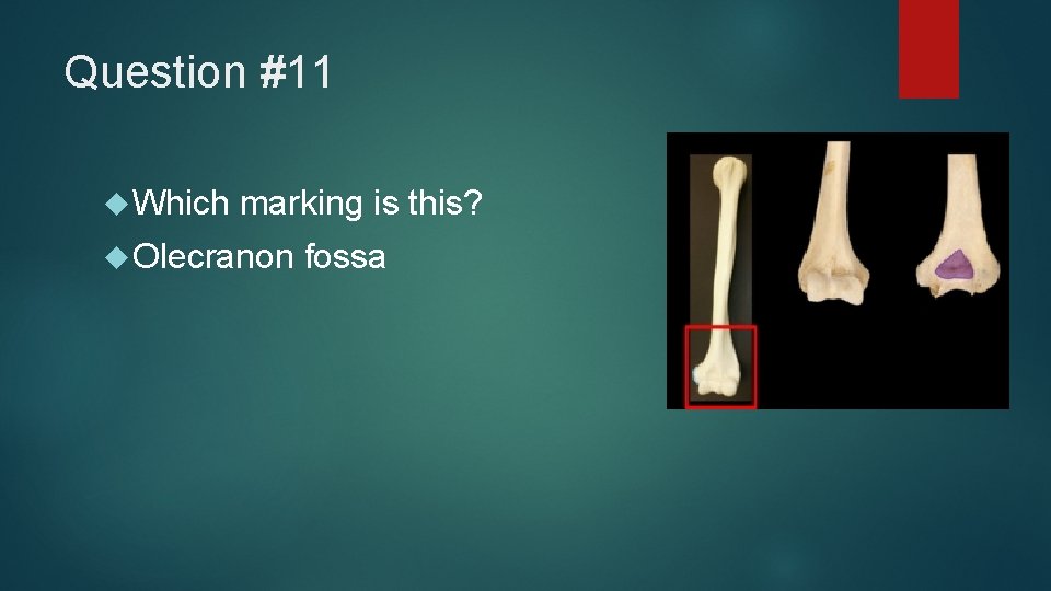 Question #11 Which marking is this? Olecranon fossa 