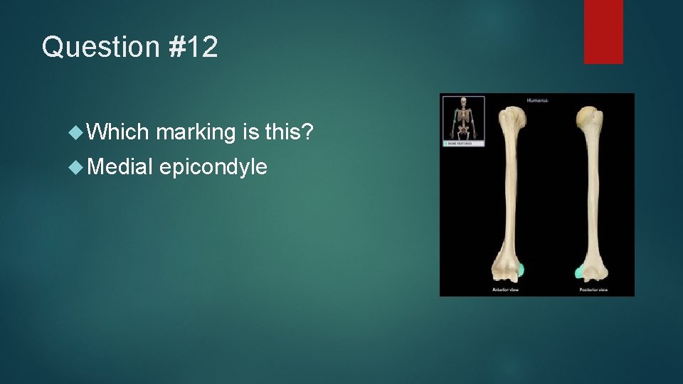 Question #12 Which marking is this? Medial epicondyle 
